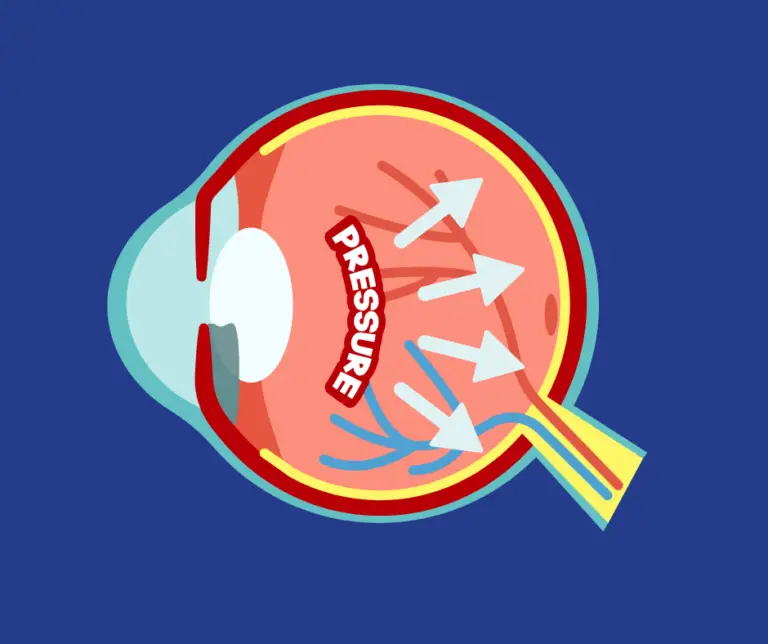 Understanding Glaucoma: Risks, Symptoms, and Research Advancements